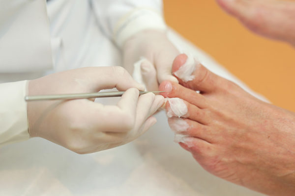 Serviços - Doctor Feet Podologia