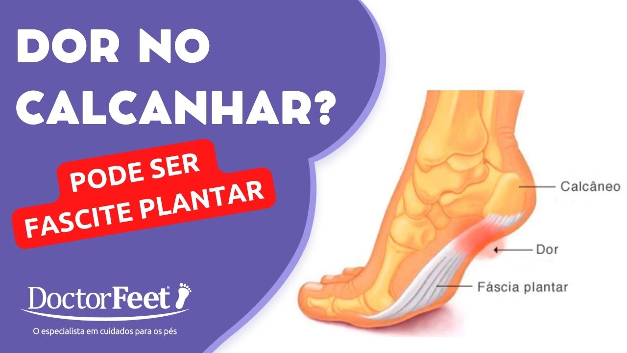 Dor no calcanhar: pode ser fascite plantar. Doctor Feet Podologia