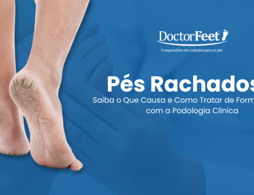 Pés Rachados? Saiba o que causa e como tratar de forma segura