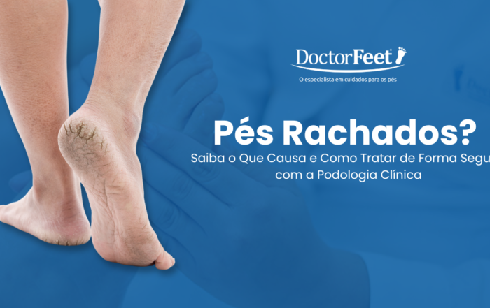 pesrachados-blogs